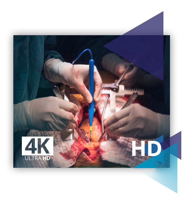 Transmisje operacji w jakości 4K